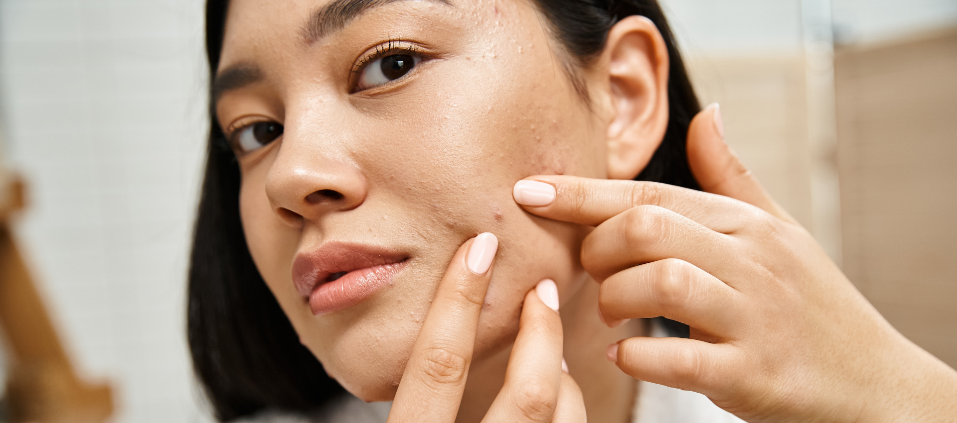 Acne Treatment Melbourne Melbourne City Dermatology